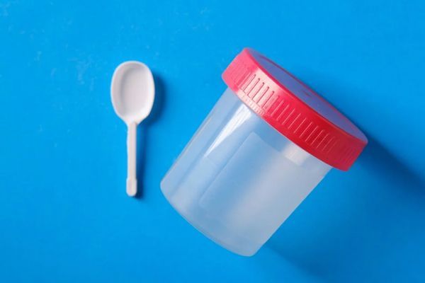 Helicobacter pylori - bote de plástico y una palita de plástico para la recogida de heces