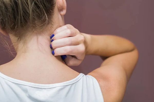 mujer blanca rascándose la parte trasera del cuello por los picores causados por la enfermedad