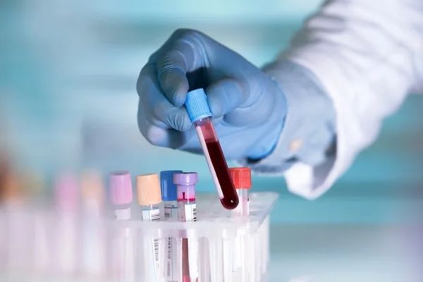 Esclerosis múltiple - técnico de laboratorio recogiendo una muestra de sangre para analizarla