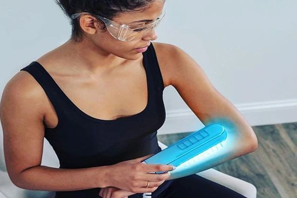 psoriasis - mujer sentada en una silla aplicándose un tratamiento de fototerapia para tratar la enfermedad en su brazo