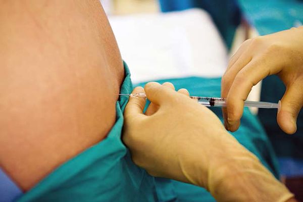 Esclerosis múltiple - especialista en el quirófano realizando una punción lumbar a un paciente