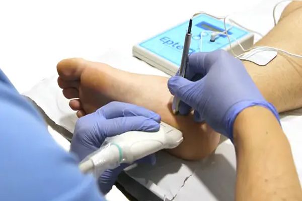 Fascitis plantar - paciente en la consulta del especialista sometiéndose a un tratamiento de reparación ultrasónica del tejido