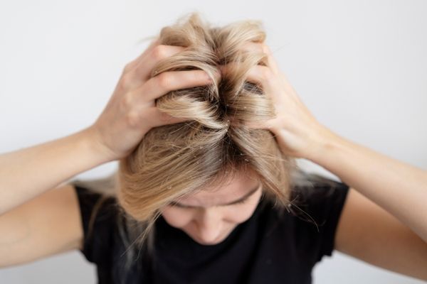 Pediculosis - Mujer abrumada por la picazón que tiene en el cuero cabelludo, causada por la infestación de piojos