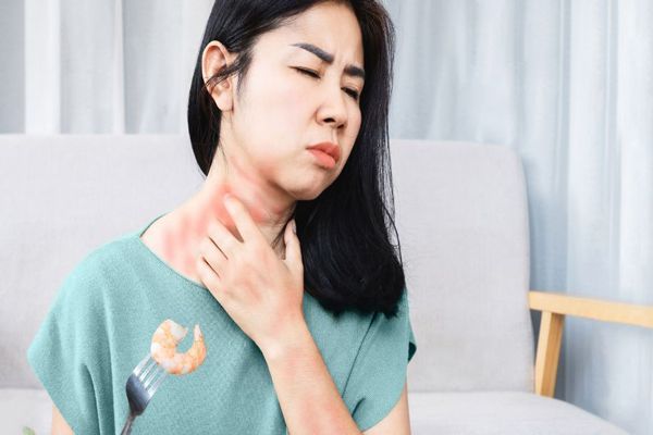 Alergias - Mujer asiática sentada en el suelo con una fuerte erupción alérgica en la zona del cuello producida por la ingesta de gambas