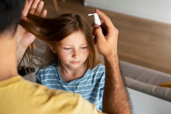 Pediculosis - Padre aplicando un tratamiento tópico para eliminar piojos en la melena de su hija