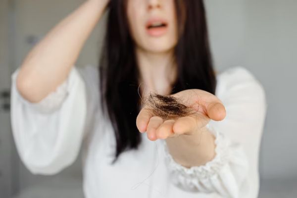 Alopecia por estrés - Mujer con un mechón de cabello en la mano angustiada por pérdida de cabello 