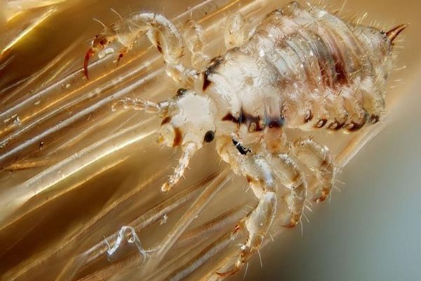 Pediculosis - imagen al microscopio de una Ninfa de piojo