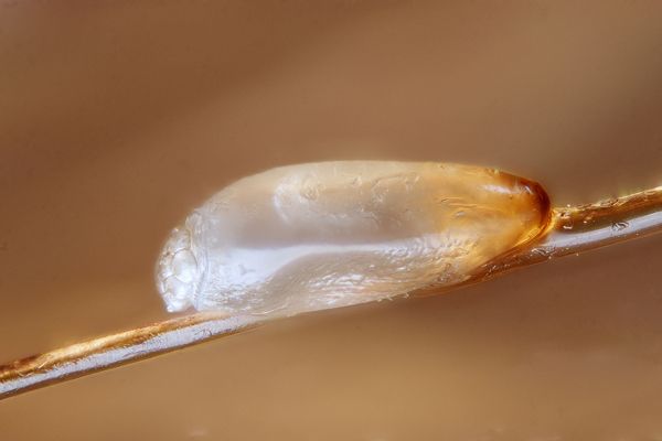 Pediculosis - Imagen de una liendre pegada al cabello