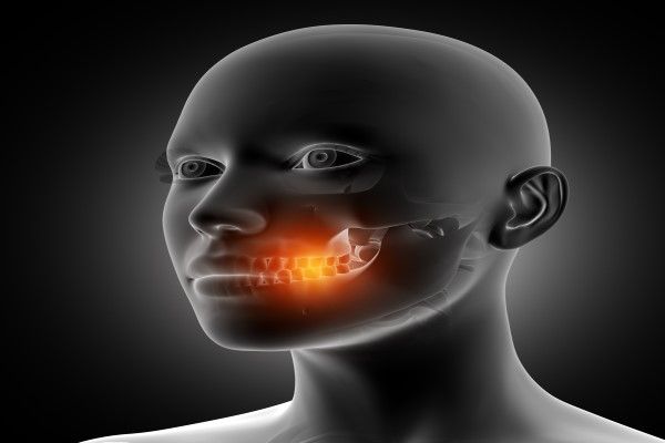 bruxismo - imagen de un modelo 3D de una mujer apretando los dientes por el bruxismo