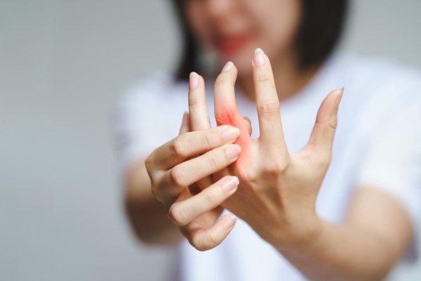 artritis - La mujer tiene dolor en las articulaciones de los dedos debido a la artritis reumatoide