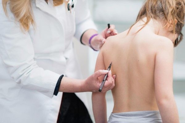 escoliosis - Fisioterapeuta examinando la postura de una niña pequeña