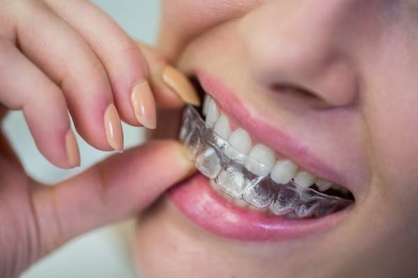 mujer colocándose una cerula dental para dormir