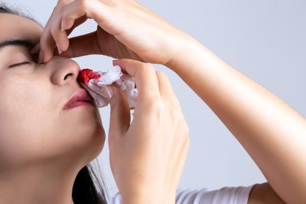 mujer con una hemorragia nasal causado por su falta