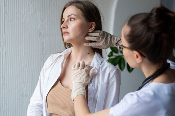 Cáncer de piel - mujer en el dermatólogo revisándose una mancha en la piel sospechosa