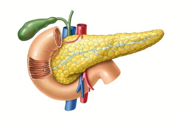 esquema de una pancreatitis