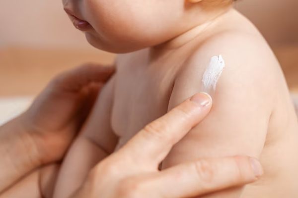 bebe sentado mientras le aplican una crema para curar una infección de la piel