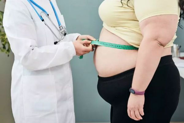 Cálculos biliares - mujer con obesidad, uno de los factores de mayor riesgo para esta enfermedad, en la consulta de su medico,