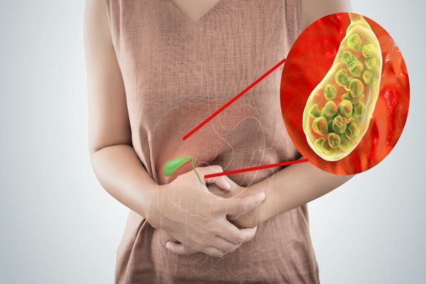 paciente agarrándose el abdomen por fuertes dolores causados por la colecistis