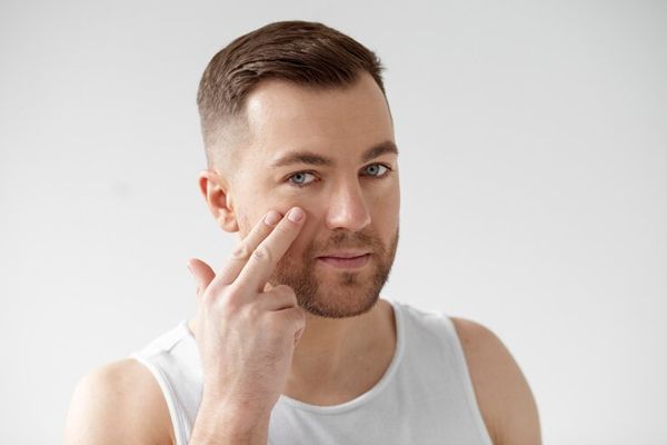Cáncer de piel - hombre blanco señalando lo que parece un carcinoma espinocelular en su rostro
