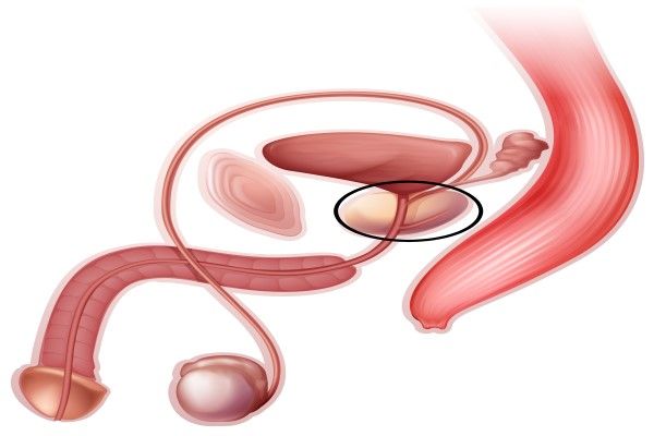 biopsia de próstata - imagen de la próstata