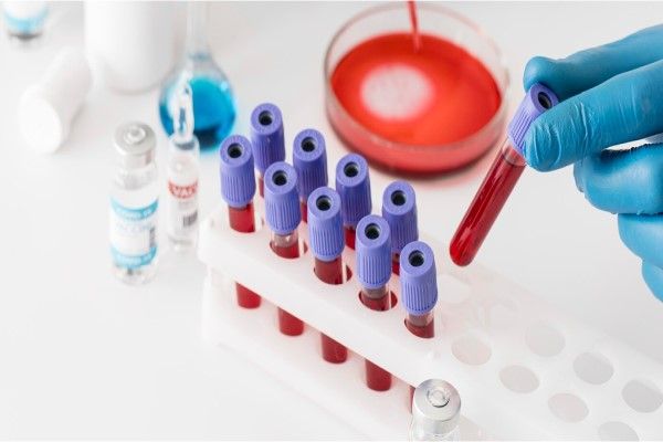 técnico de laboratorio preparando un cultivo de sangre