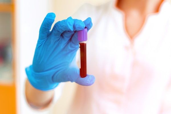 Vial lleno de sangre en la mano de un especialista de laboratorio