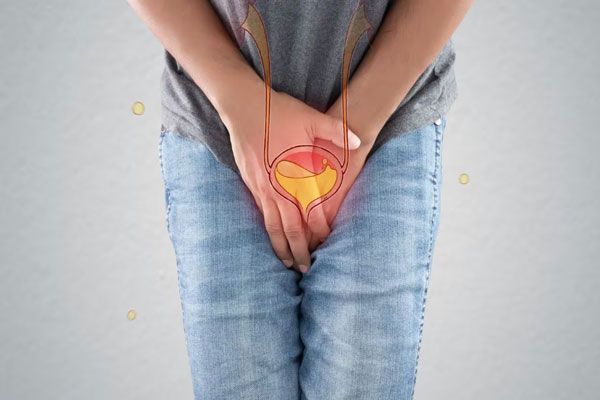 Clamidia - Paciente masculino presenta un persistente ardor urinario como para de los síntomas de una ETS 