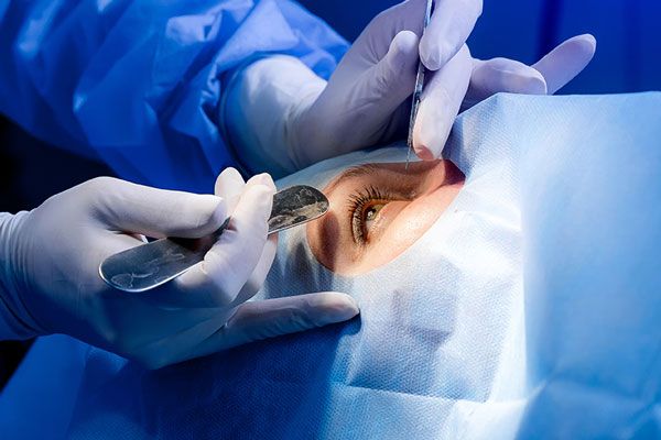 Cirujano prepara el rostro de una paciente para proceder a realizar una cirugía ocular