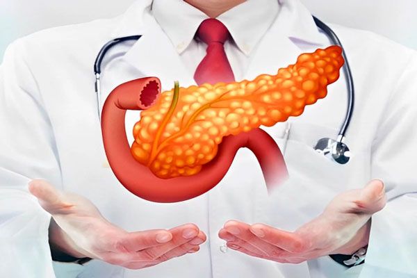 Diabetes - Imagen ilustrada hace alusión a la importancia que tiene el páncreas en el organismo 