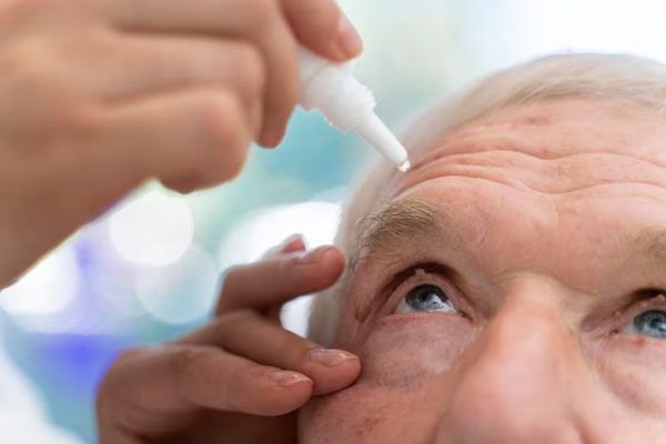 Glaucoma - Adulto mayor levanta la vista mientras le aplican unas gotas para disminuir la presión ocular