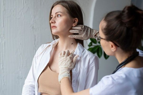 Verrugas comunes - Paciente preocupada acude al dermatólogo por la aparición de un lunar irregular en el cuello