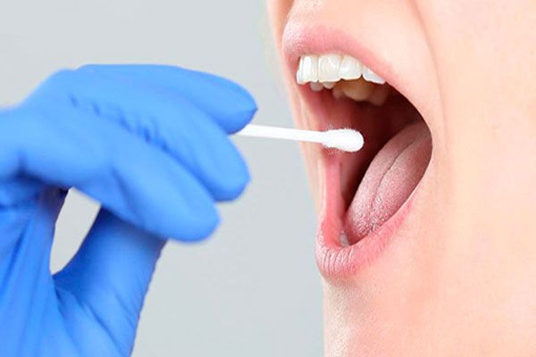 Escarlatina - Personal de la salud toma una muestra de saliva de un paciente para llevar a cabo un análisis bacteriológico 