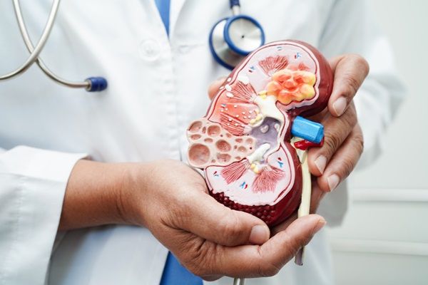 Pielonefritis - Médico mostrando un modelo de la parte interior de un riñón