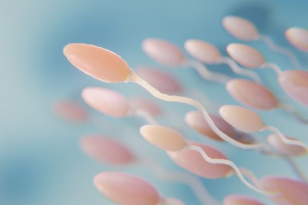 Azoospermia - Dibujo representativo de varios espermatozoides