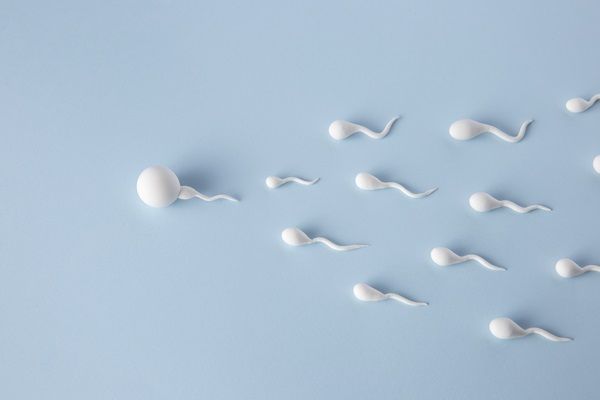 Azoospermia - Dibujo de varios espermatozoides intentando llegar al óvulo