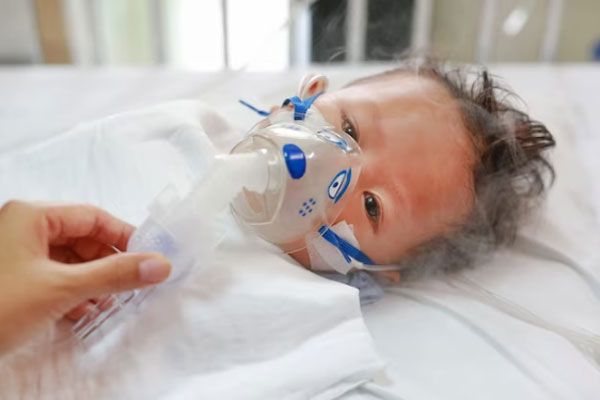 Progeria neonatal - Bebé enfermo respira con ayuda de mascarilla de oxígeno 
