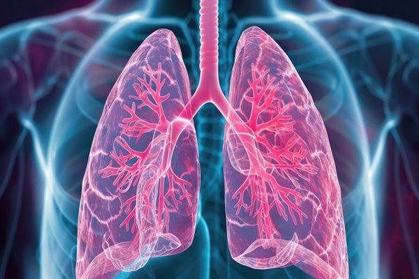 Derrame pleural - Dibujo de la anatomía del sistema respiratorio humano