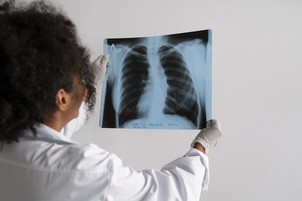 Médico especialista observando una radiografía de tórax