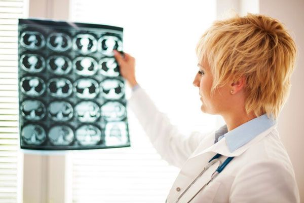 Doctora sostiene y evalúa la placa de una tomografía cerebral