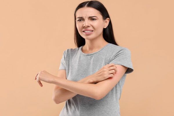 Dermatitis por estrés - Mujer con alergia cutánea rasca su brazo de forma persistente