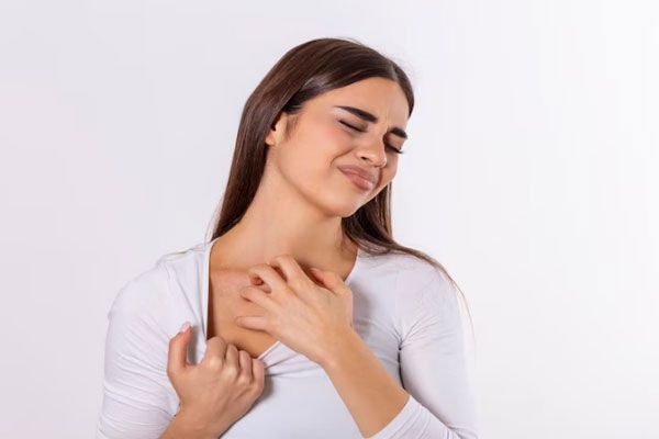 Joven con alergia experimenta un persistente picor en la piel