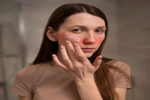 Dermatitis por estrés - Joven se aplica una crema humectante para prevenir la resequedad y mejorar la hidratación de la piel