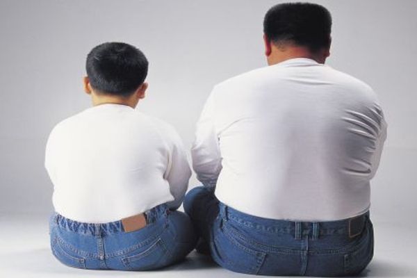 Tipos de obesidad - padre e hijo obesos uno al lado del otro, ejemplo de la obesidad por la genética