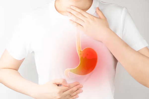 Problemas intestinales – Persona tocándose la garganta y el abdomen, con signos de reflujo gástrico, un síntoma común en problemas intestinales