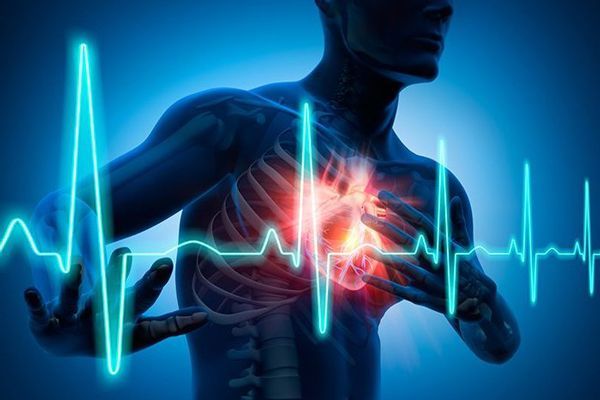 Insuficiencia cardíaca- Imagen que muestra una insuficiencia cardiaca