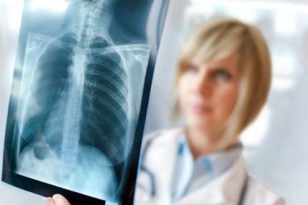 especialista revisando una radiografía en busca de anomalías respiratorias