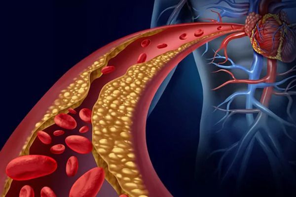 Gráfico que muestra las arterias
