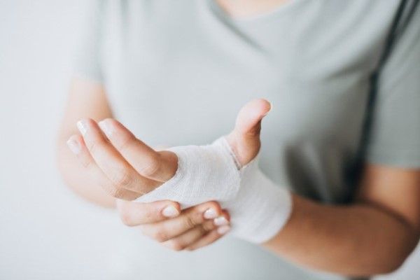 Fractura del escafoides - mujer sujetándose la muñeca vendada tras una factura del escafoides