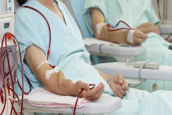 Diferencia entre diálisis y hemodiálisis- paciente recibiendo hemodialisis