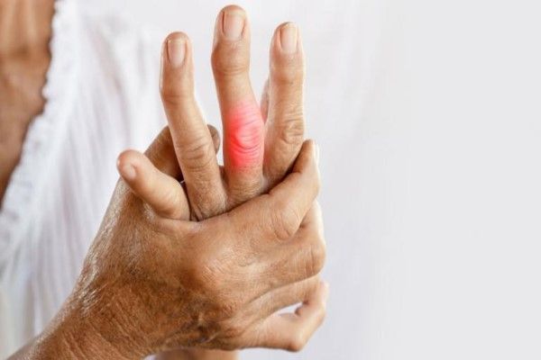 Anciana con los dedos deformados por la rotura de alguna falange y metacarpiano en su mano